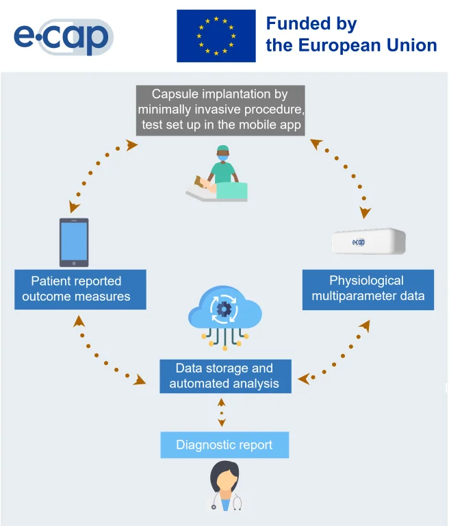eCAP project diagram: Capsule implantation by minimally invasive procedure, test set up in the mobile app, leads to patient reported outcome measures and physiological multiparameter data, leads to data storage and automated analysis, leads to diagnostic report